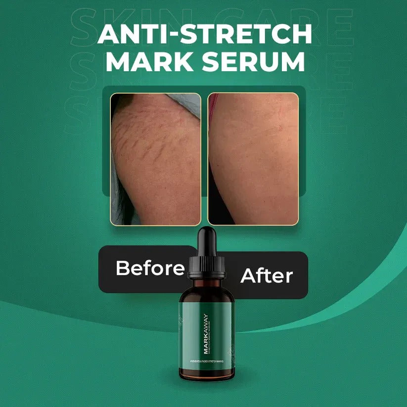 MARKAWAY STRECH MARK SERUM
